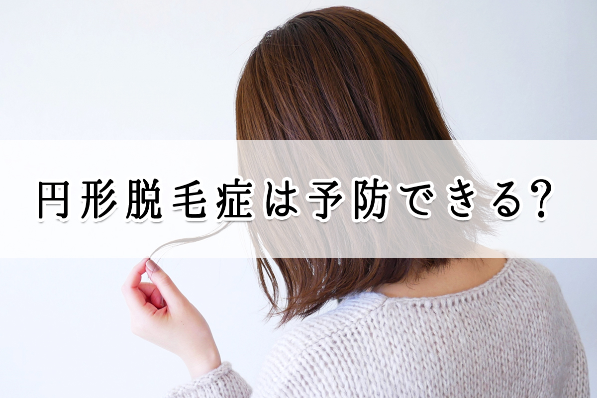 円形脱毛症の予防