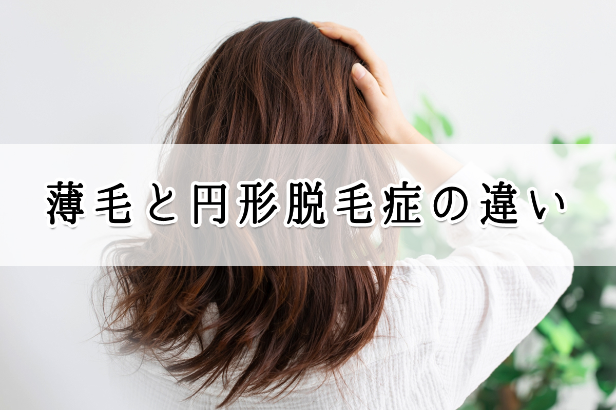 薄毛と円形脱毛症の違い