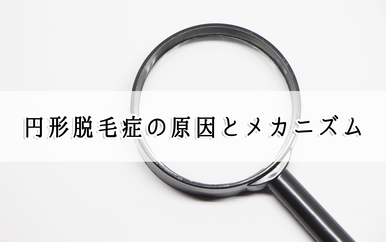 円形脱毛症の原因とメカニズム