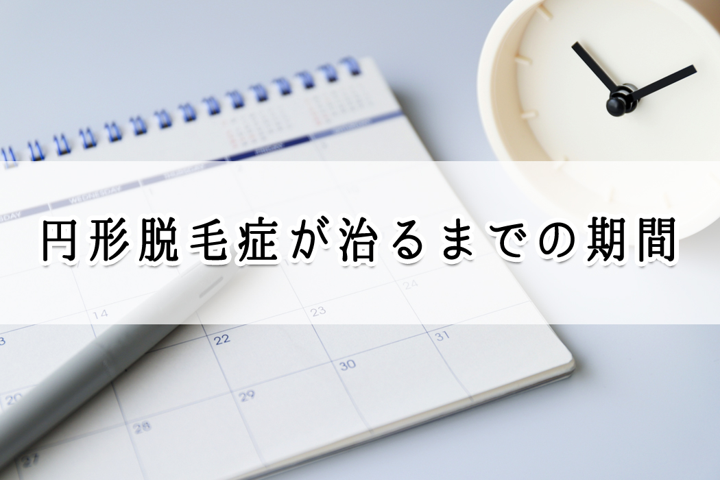 円形脱毛症が治るまでの期間